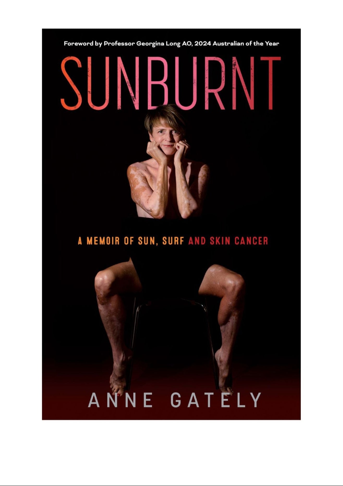 Sunburnt. PAPERBACK